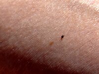 Paolo ha "catturato" una zecca  20250515 112617